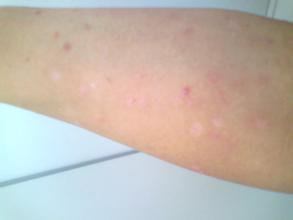 Ƥ��������������ϰ����Ǯ