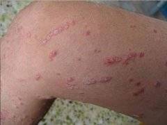 ţƤѢ���˺�̺�����ȥ��