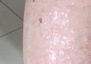 ����Ƥ����ҽԺ�û��ǻ���Ƥ������