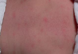 ����ȽϺõ���м��ҽԺ���ĸ�