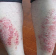 ������ţƤѢ���ߵ�Ӱ���ж��