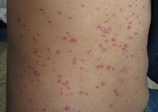 ţƤѢ������Ҫ������