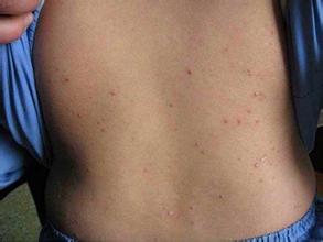 ţƤѢ�ļ��������ǵ����������Щ��Ӱ��