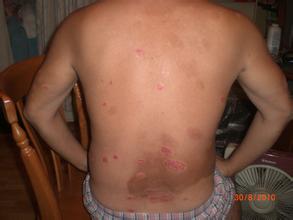 ����Ӧ����ôԤ��ţƤѢ�ķ���