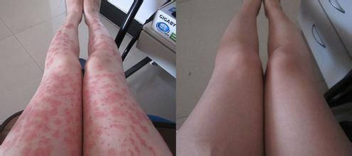 ��ţƤѢ���������ȷ�ı������Լ���Ƥ��