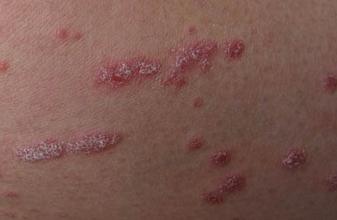 ��������ҽԺ������м���Ϻ�