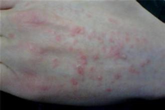 ��������ҽԺ������м���ȽϺ�